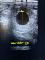 16 day scan